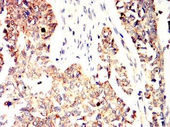 CD36 Antibody