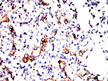 CD36 Antibody