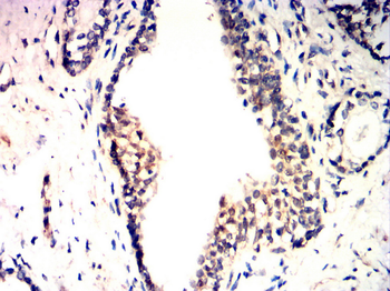 AKT2 Antibody