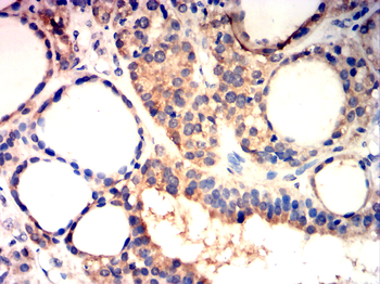 AKT2 Antibody