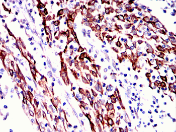 ACTB Antibody