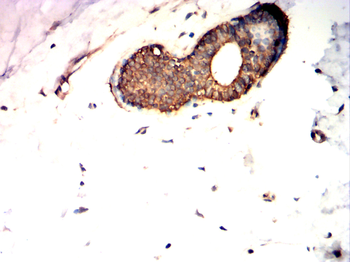 BRAF Antibody