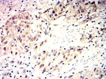 BRAF Antibody