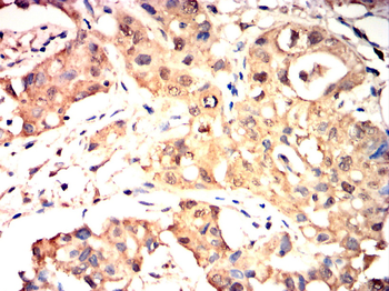 BRAF Antibody