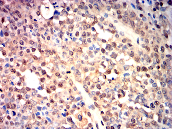 BRAF Antibody