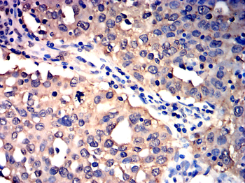 BRAF Antibody