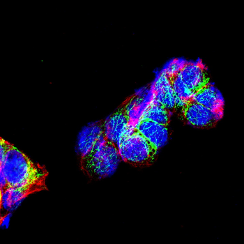 CHEK2 Antibody