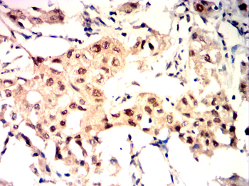 CHEK2 Antibody