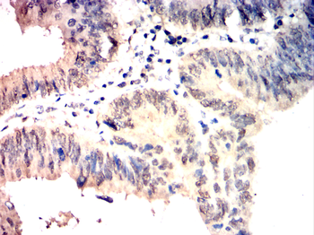 CHEK2 Antibody