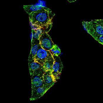 GSK3B Antibody