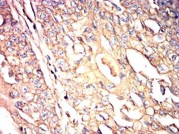 GSK3B Antibody