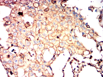GSK3B Antibody