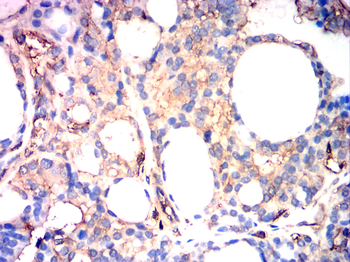 GSK3B Antibody