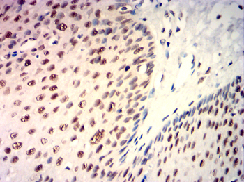 KDM1A Antibody