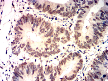 KDM1A Antibody