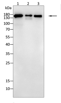 MSH6 Antibody