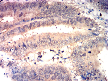 PAK2 Antibody