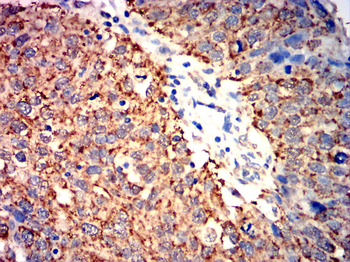 PHB Antibody
