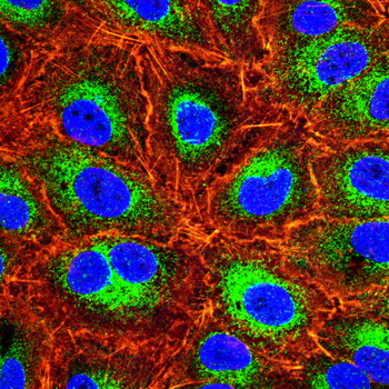 LIMS1 Antibody