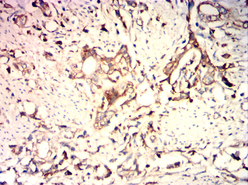 LIMS1 Antibody