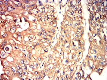 LIMS1 Antibody
