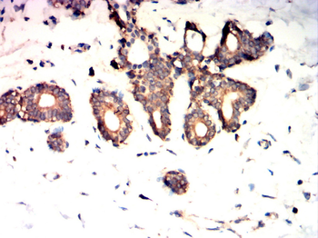 LIMS1 Antibody
