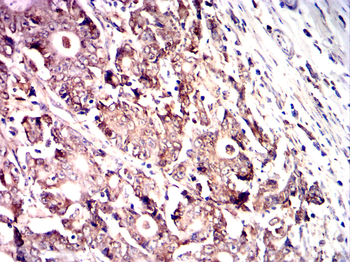 LIMS1 Antibody