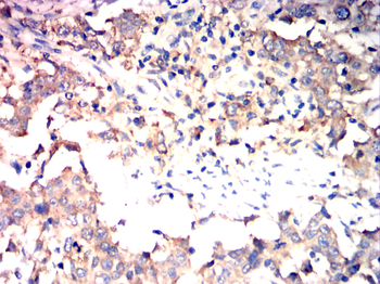 LIMS1 Antibody