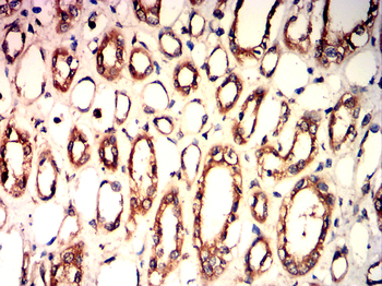 LIMS1 Antibody