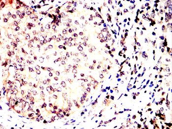 HSPA8 Antibody
