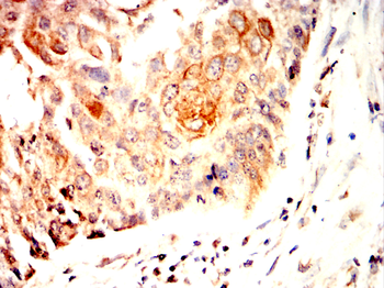 RHOA Antibody