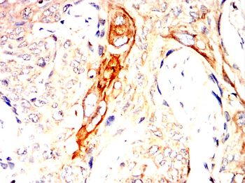 RHOA Antibody