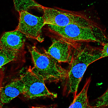 AGER Antibody