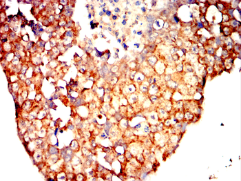 AGER Antibody