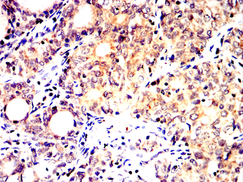 AGER Antibody