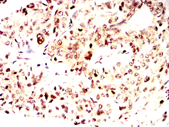 AGER Antibody