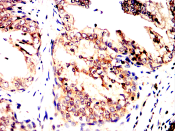 AGER Antibody