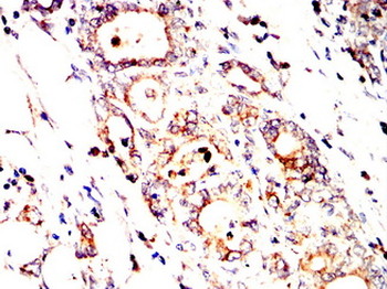 AGER Antibody