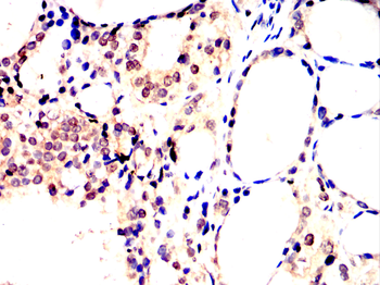 ETS1 Antibody
