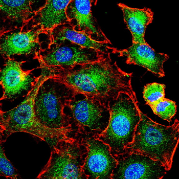 STUB1 Antibody