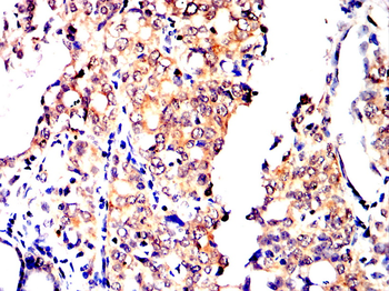 STUB1 Antibody