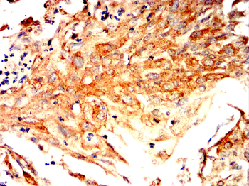 STUB1 Antibody