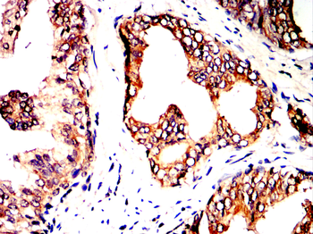 STUB1 Antibody