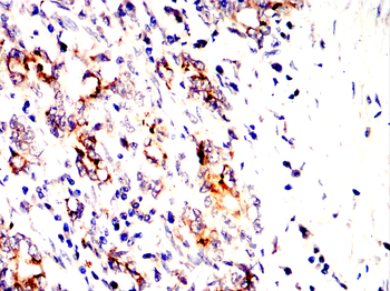 STUB1 Antibody