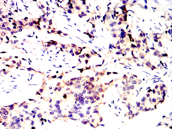 VDR Antibody