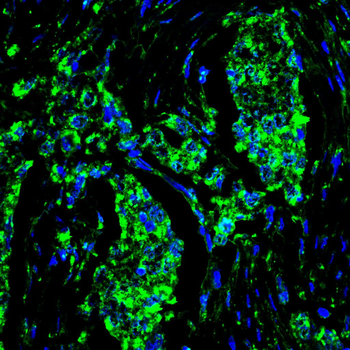 VDR Antibody