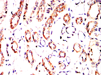 VDR Antibody