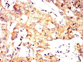 VDR Antibody