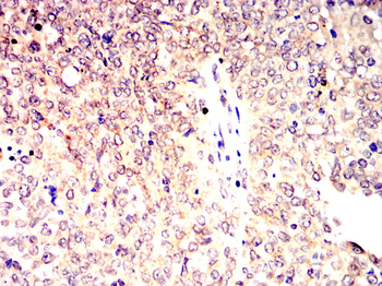VDR Antibody