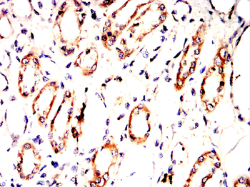 PRDX1 Antibody